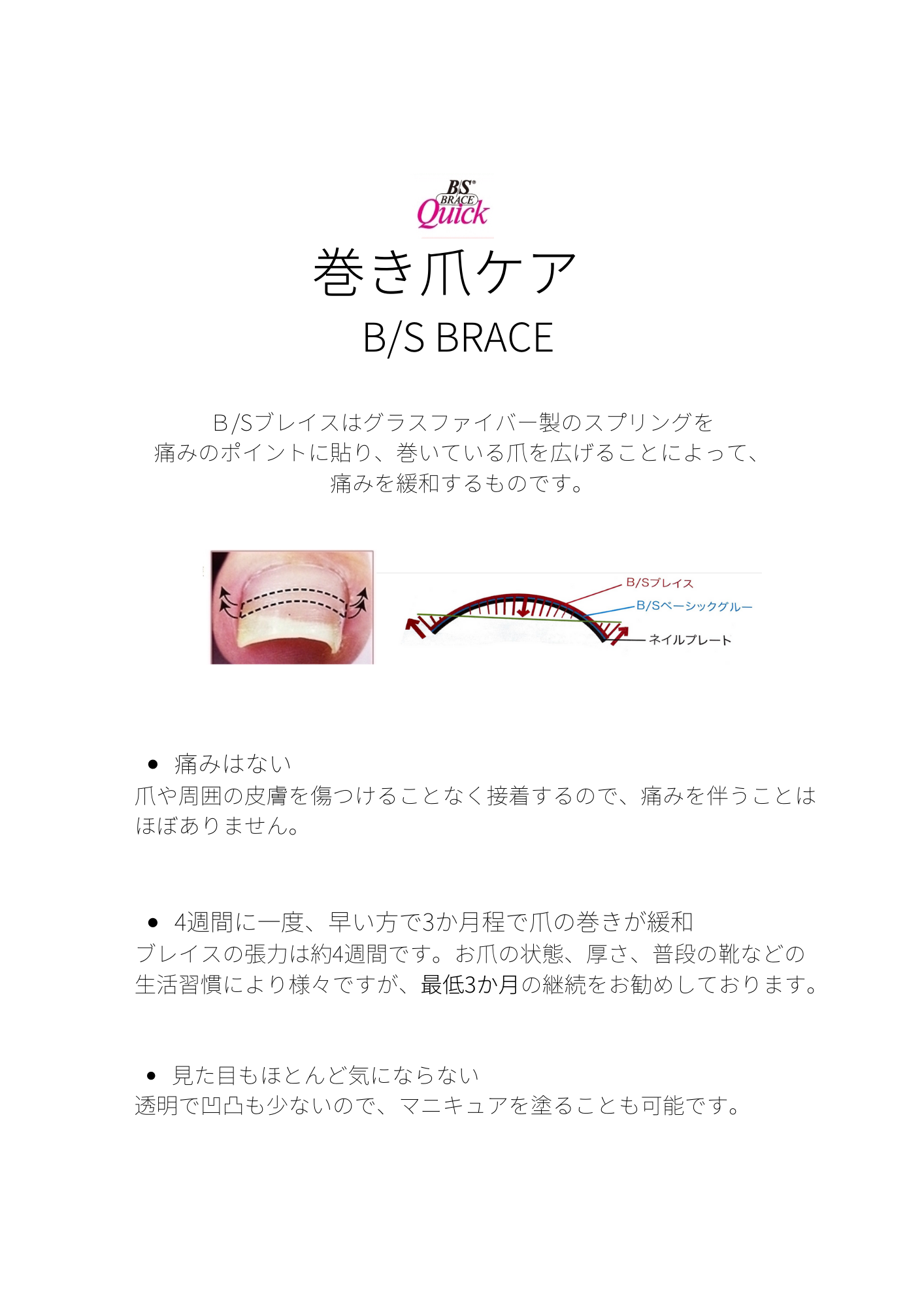 巻き爪ケア スタートしています